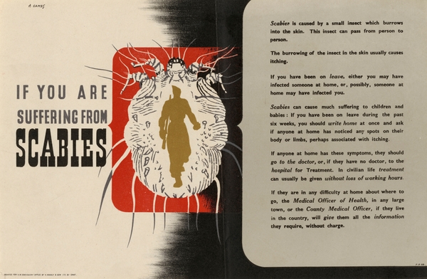 If You are Suffering from Scabies Print