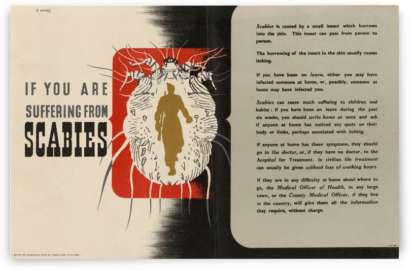 If You are Suffering from Scabies by IStockHistory com