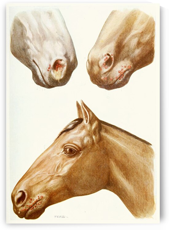 Stomatitis Eruptions Amedeo John Engel Terzi Italian 1872-1956 by IStockHistory com